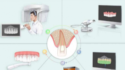 改变根管治疗：精准牙科的兴起