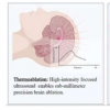 磁共振引导聚焦超声治疗颅内疾病