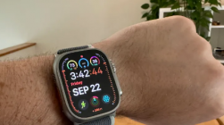 Apple Watch 终于可以让你监测血糖了