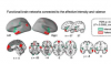 机器学习和 fMRI 揭示持续痛苦和快乐的大脑活动模式