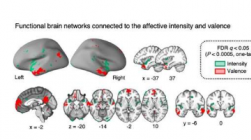 机器学习和 fMRI 揭示持续痛苦和快乐的大脑活动模式