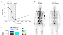 晚期前列腺癌 CAR-T 细胞疗法在 I 期临床试验中取得积极成果