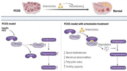 抗疟药有望治疗多囊卵巢综合征