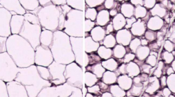 研究人员找到将体内坏脂肪转化为好脂肪的方法