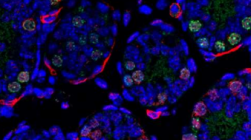 科学家确定了男性生育能力的关键调节因子