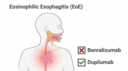 两项研究显示治疗嗜酸性食管炎的进展不一