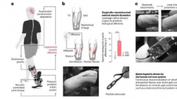 由神经系统驱动的假肢帮助截肢患者自然行走