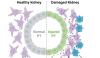 新研究表明小鼠急性肾损伤后细胞参与了不健康的关系