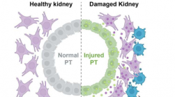 新研究表明小鼠急性肾损伤后细胞参与了不健康的关系