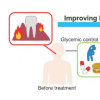 研究表明强化治疗糖尿病可以减轻牙龈疾病炎症