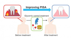 研究表明强化治疗糖尿病可以减轻牙龈疾病炎症